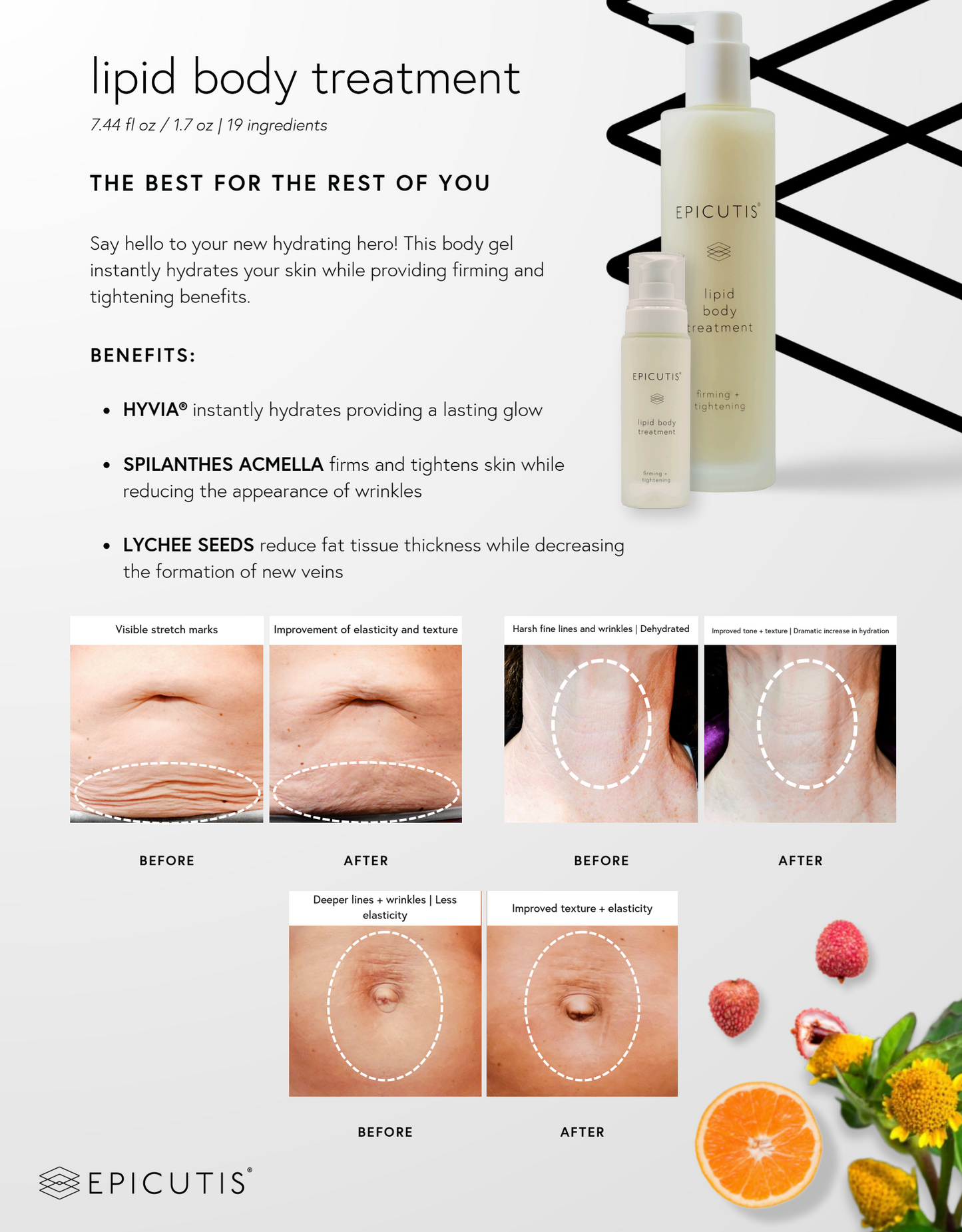 Lipid Body Treatment TRAVEL