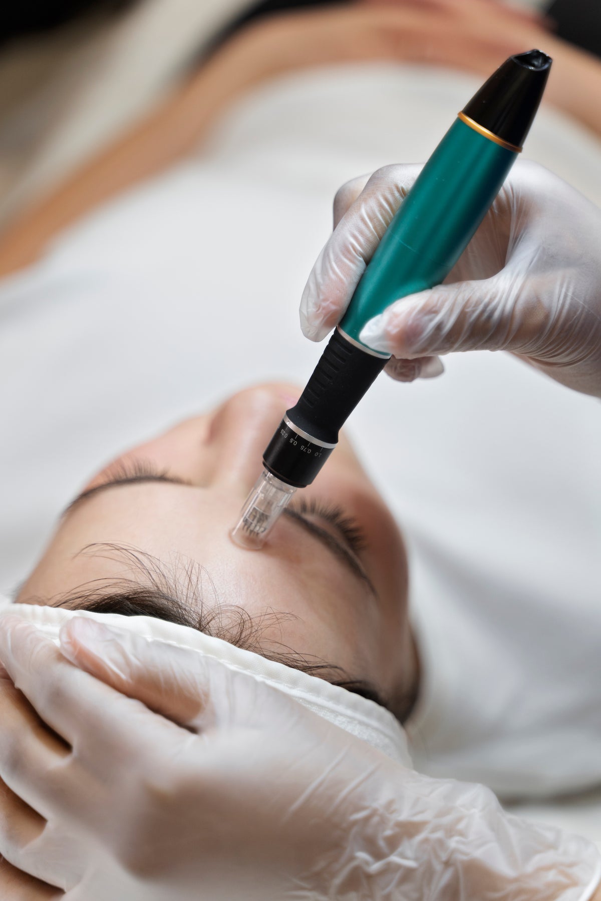 Natural Skin Rejuvenation with SkinPen® Technology